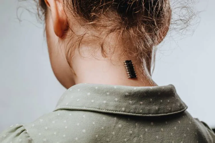 Implantation chip gps enfant